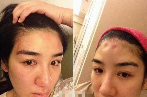 吃瓜怀孕家暴,揭开家庭悲剧背后的真相