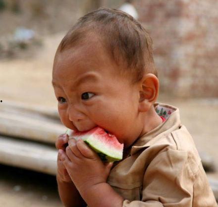 吃小瓜会头晕,营养美味背后的健康警示